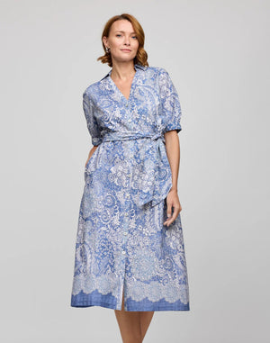 A person with shoulder-length hair wears the HINSON WU Luca Elbow Sleeve Lace Print Dress, a blue and white breathable dress featuring short sleeves, a belted waist, and a hand in a pocket against a plain background.