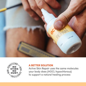 A 3 fl oz white bottle and yellow box of ACTIVE SKIN REPAIR - HYDROGEL by the brand ACTIVE SKIN REPAIR. This medical-grade, sting-free product utilizes hypochlorous (HOCl) to support the body's natural healing process. The packaging includes text and icons that highlight its usage and benefits.